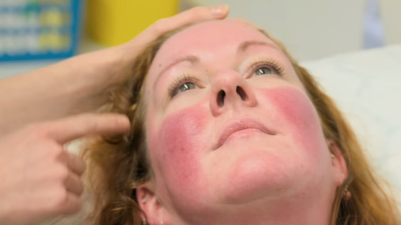 A client on Save My Skin