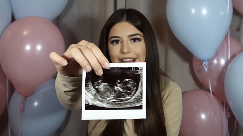 Sophia Grace Brownlee holding a picture of her sonogram