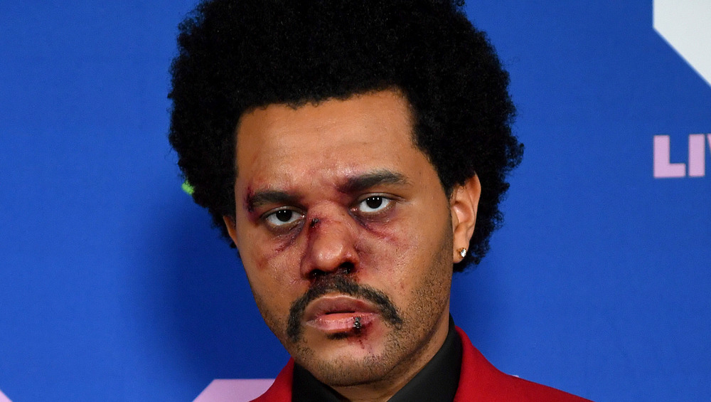 The Weeknd with a bruised face