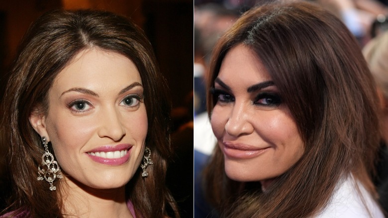 Kimberly Guilfoyle before after photos