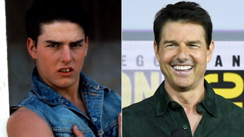 tom cruise fake teeth outsiders