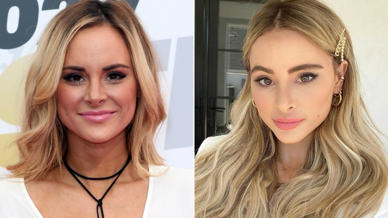 Amanda Stanton plastic surgery before and after