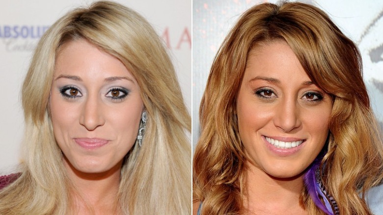 Vienna Girardi plastic surgery before and after