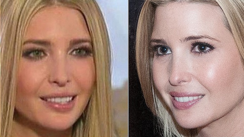 Ivanka Trump green eyes and brown eyes