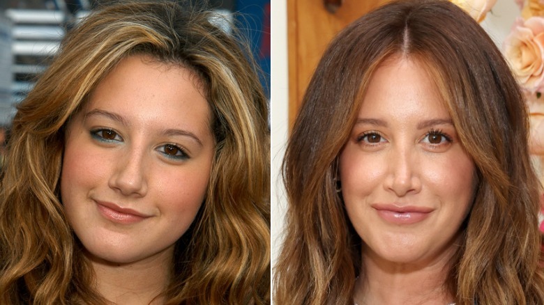 Side-by-side pictures of Ashley Tisdale smiling before and after her nose job