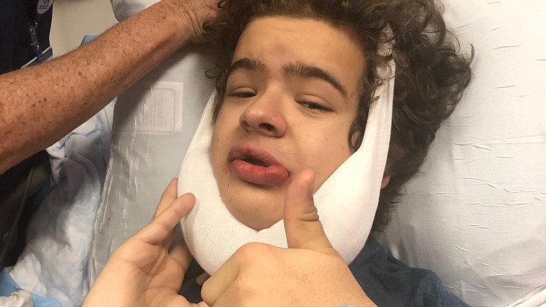 Gaten Matarazzo after getting oral surgery