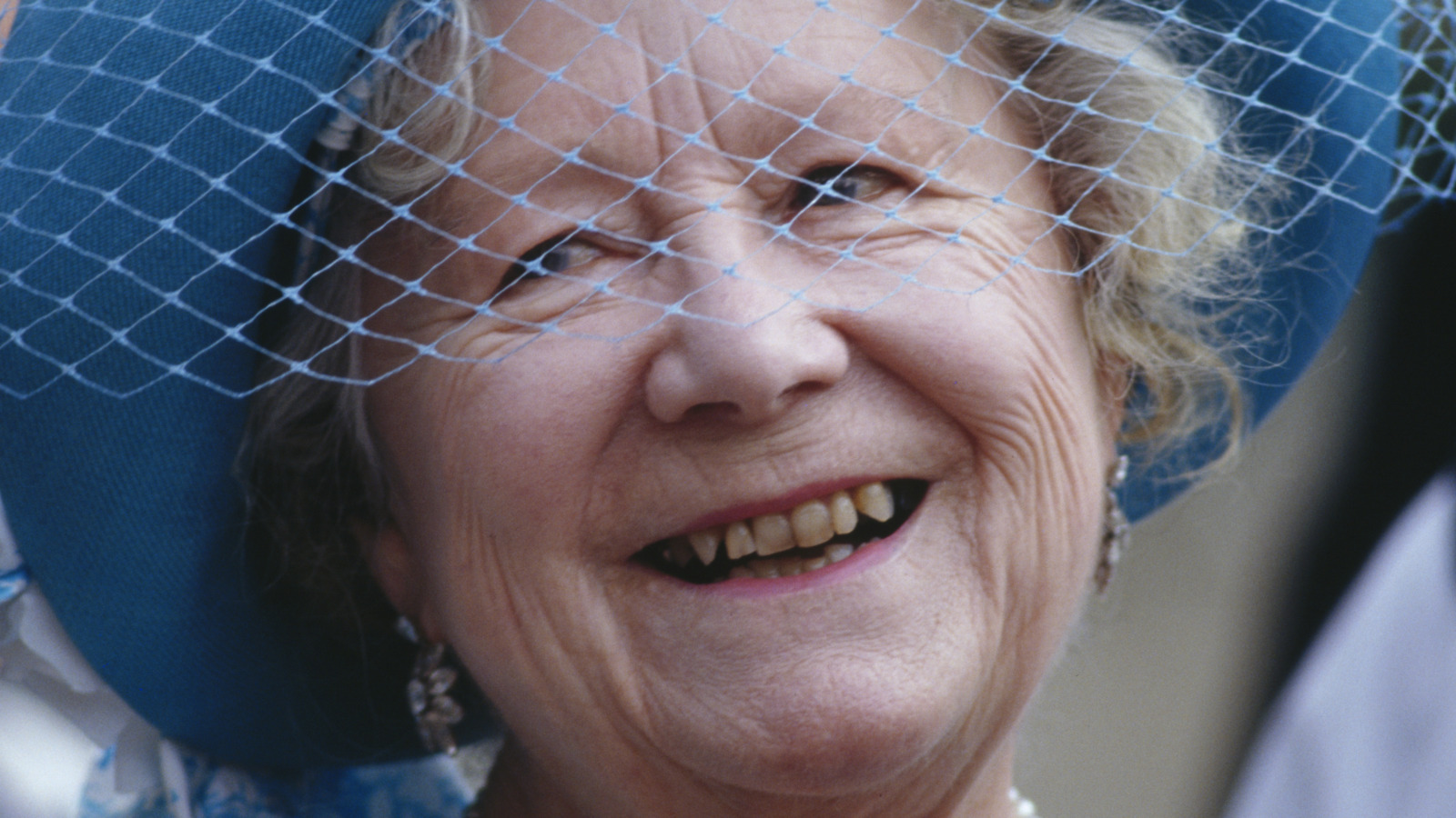 What was wrong with the queen mothers teeth