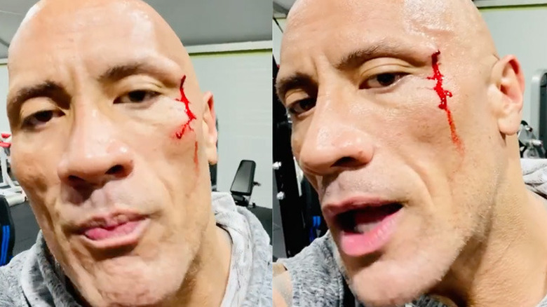 Dwayne Johnson with cut face