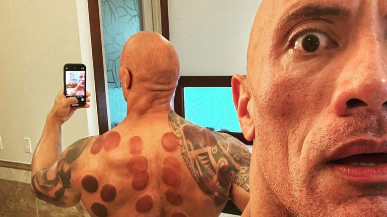 Dwayne Johnson with cupping marks