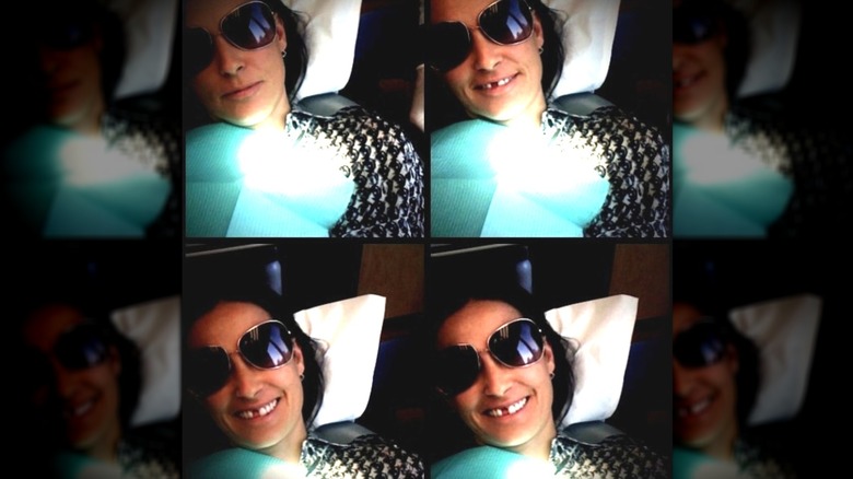 Demi Moore with missing tooth