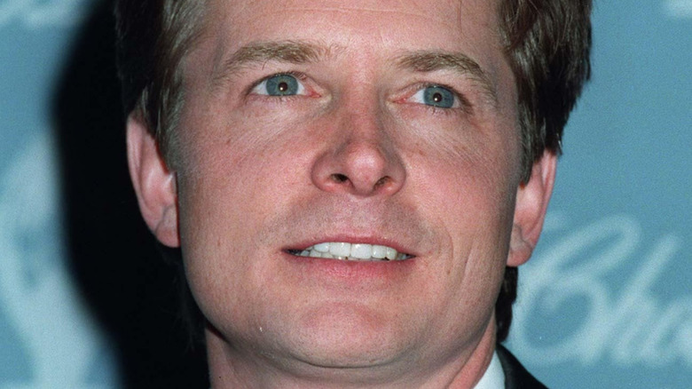 Michael J. Fox looking up