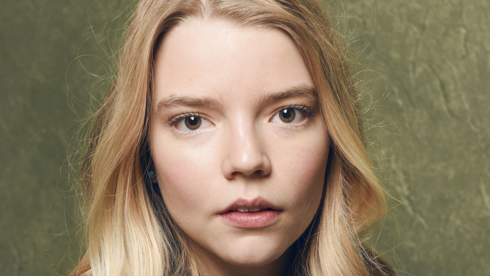 Anya Taylor Joy Waardenburg Syndrome