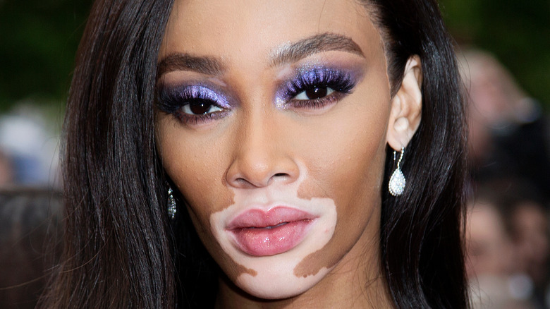 Winnie Harlow on red carpet 