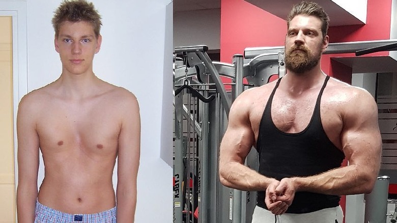 Olivier Richters before and after surgery