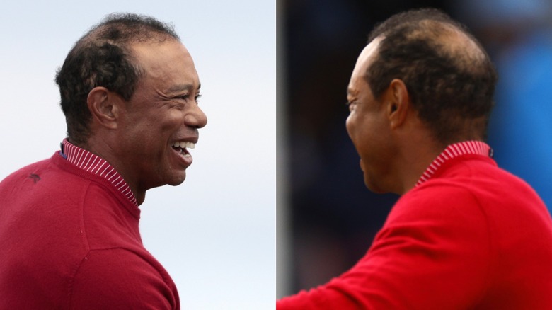 Tiger Woods bald head showing on the golf course