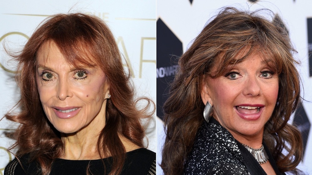 Tina Louise and Dawn Wells smiling