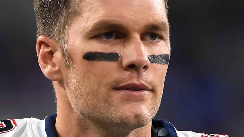 Tom Brady looking on before game