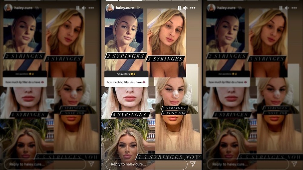 Too Hot to Handle Haley Cureton's cosmetic procedures pictures