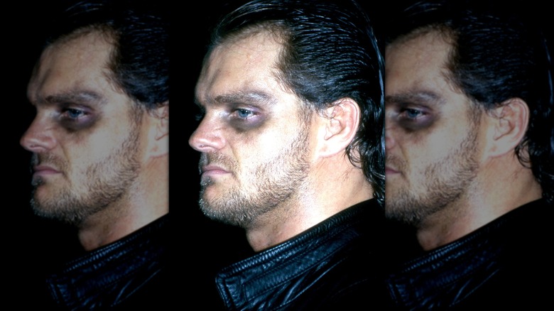 Chris Benoit shows off a black eye