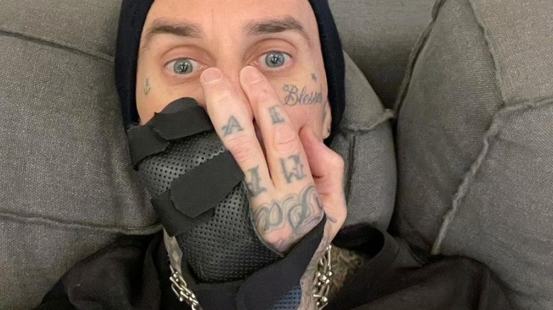 Travis Barker with broken fingers