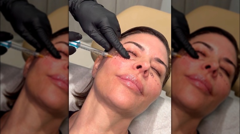 Lisa Rinna getting filler injection