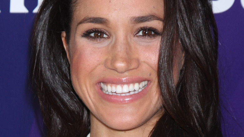 Meghan Markle teeth