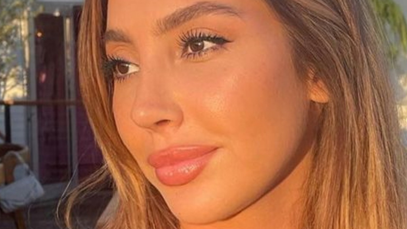 jordana siesta key plastic surgery Image 4