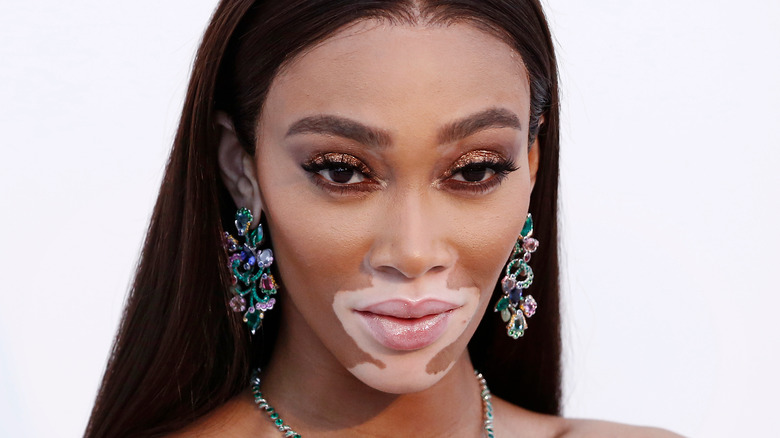 Winnie Harlow teaches Kyle Kuzma about skincare – Morning Journal