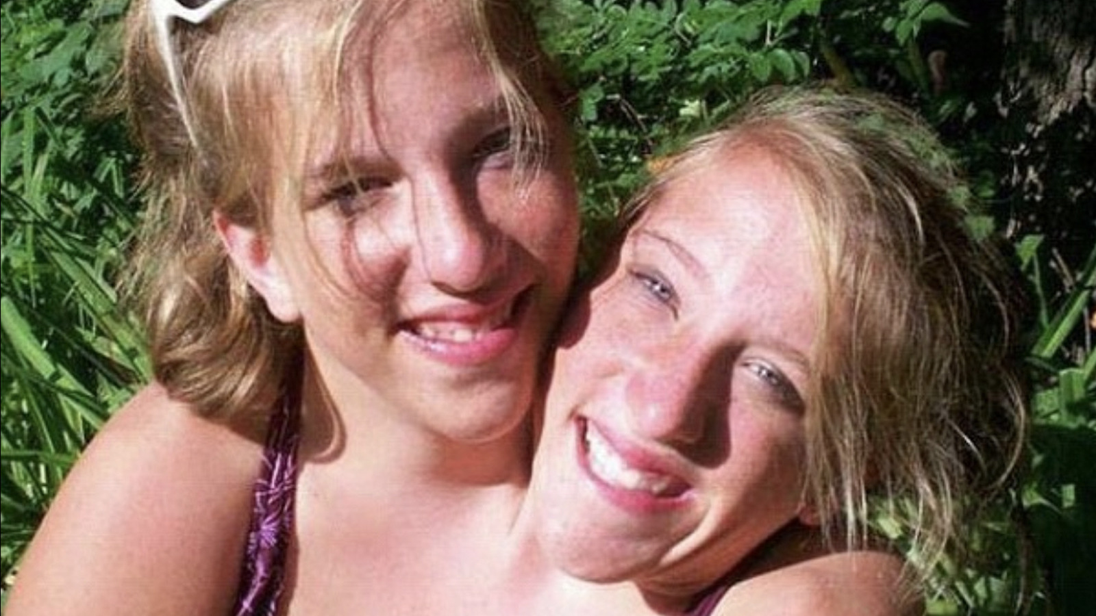 Abigail & Brittany Hensel - The Twins Who Share a Body - Mirror Online