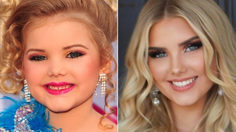 Toddlers And Tiaras Before And After