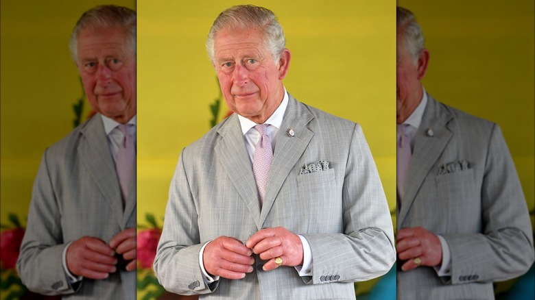 King Charles with swollen hands