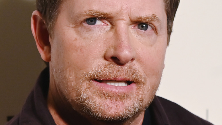 Michael J. Fox looks serious