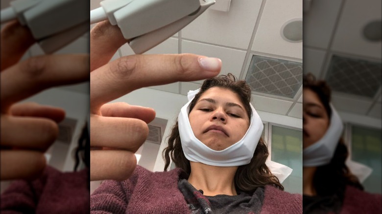 Zendaya with ice pack on head