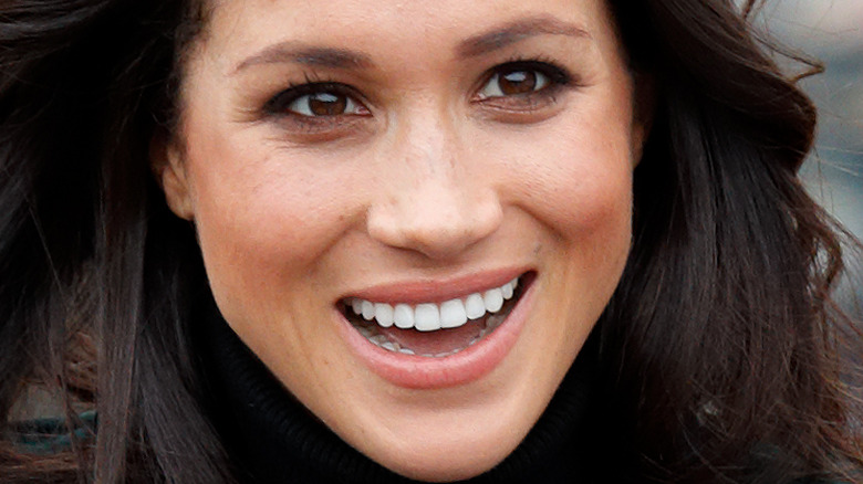 Meghan Markle teeth