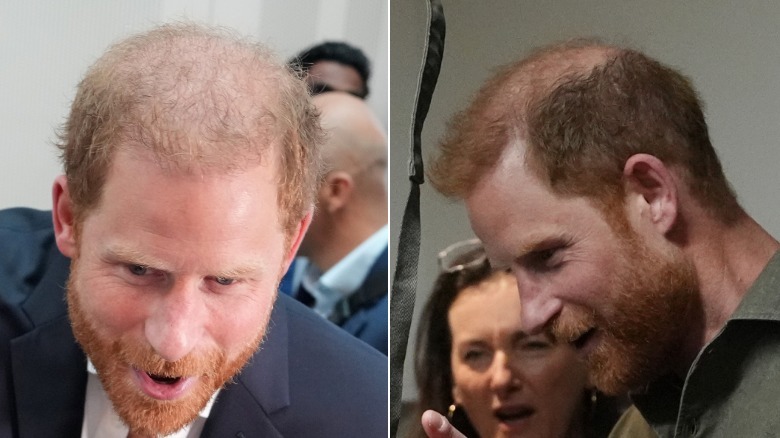 Prince harry hair