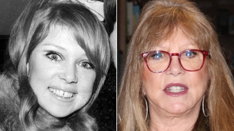 Side by side of Pattie Boyd before and after teeth procedure