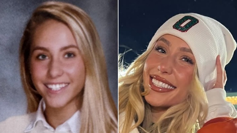 Split image of Alix Earle's yearbook photo before veneers and wearing a Miami Dolphins hat after veneers.