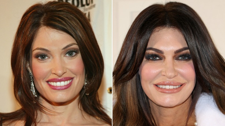 Kimberly Guilfoyle before and after