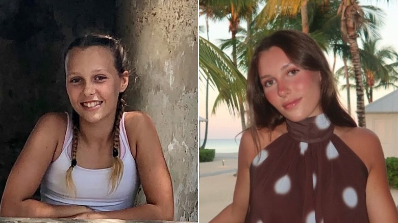 Charlotte Baeumler before and after