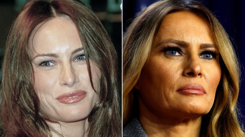 Side by side pictures of Melania Trump in 1999 vs 2024
