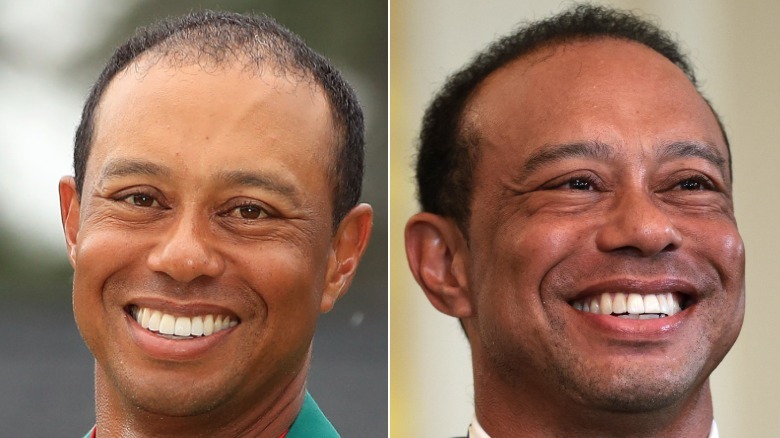 Side by side pictures of Tiger Woods in 2024 vs 2025